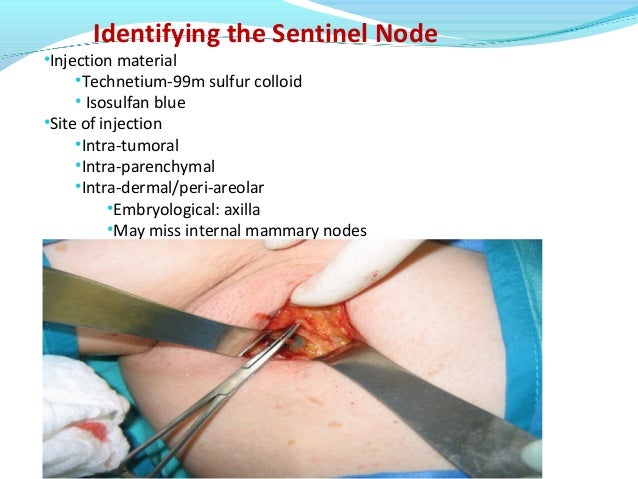 breast sentinel node injection Breast sentinel node injection